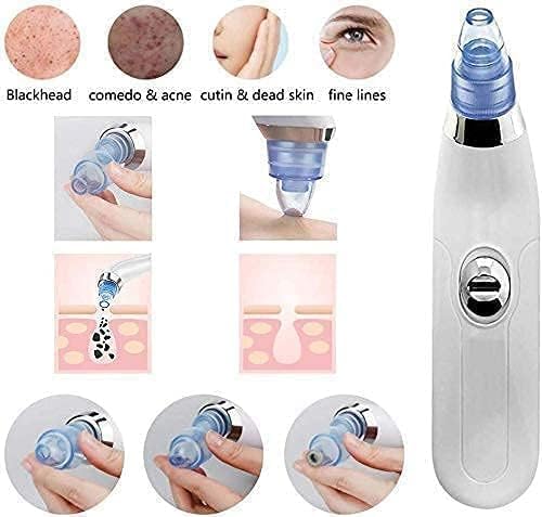 Blackhead Remover Extractor