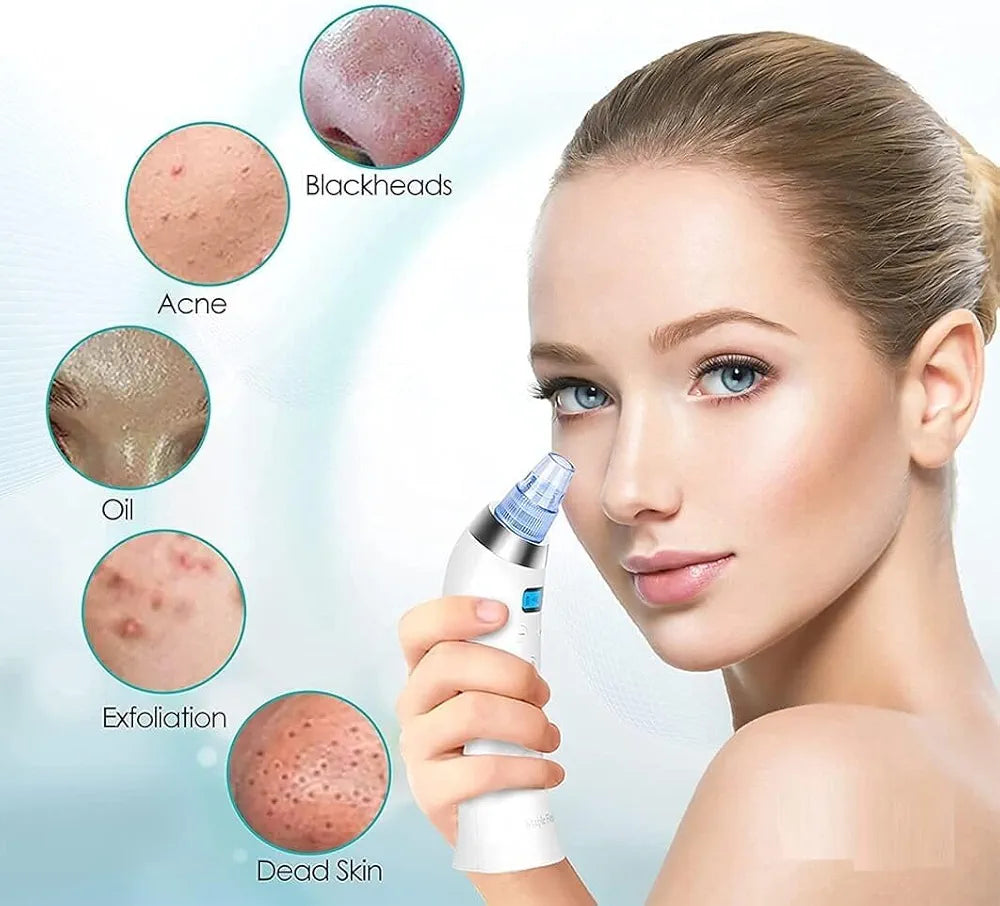 Blackhead Remover Extractor